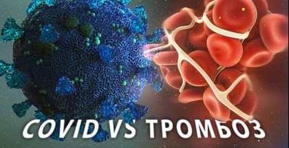 Тромбопрофілактика при коронавірусі
