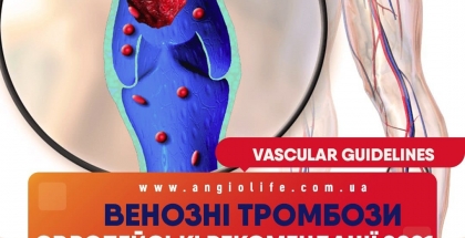 Diagnosis of venous thrombosis during COVID 19