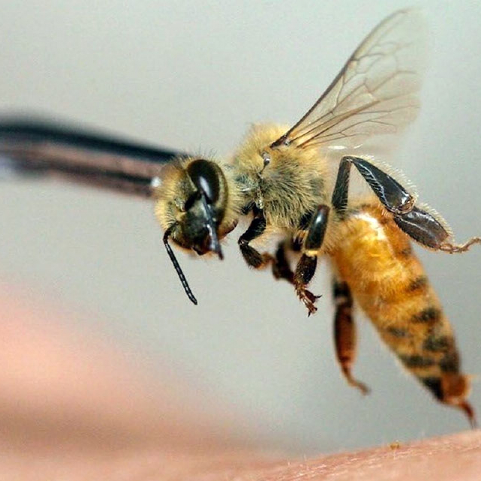 Лікування варикозу п'явками та бджолами Користь чи шкода?