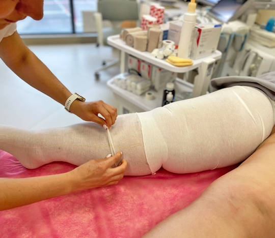 Лікування лімфостазу ніг та набряків - КФПТ