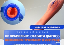 Нові стандарти для встановлення діагнозу «Тромбоз глибоких вен» 2021
